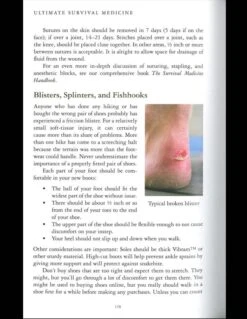 The Ultimate Survival Medical Guide 8 The Ultimate Survival Medical Guide -Outdoor Equipment Store bk318det3 31537.1587395007